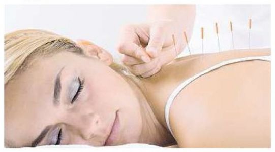 Worried About Your Weight - Try Acupuncture