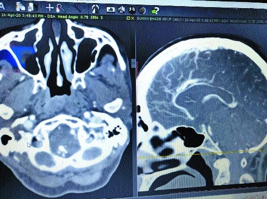 Super Speciality Hospital