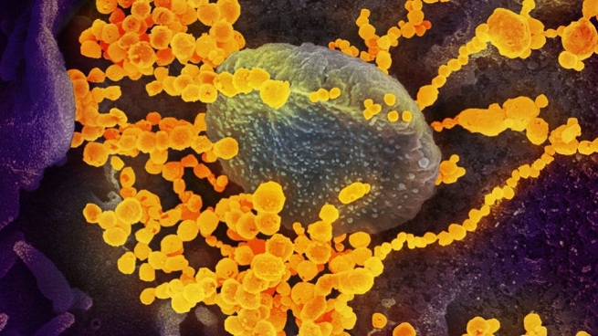 coronavirus_1&nbsp;&nbsp;