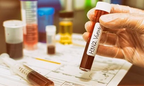 Entry of H3N2 influenza in MP, first case in Bhopal