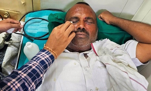 attacking BJP Corporator