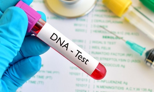 DNA sample