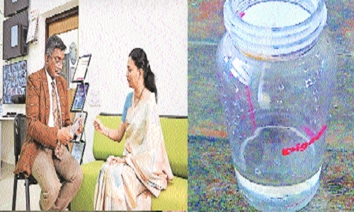 City researchers' solution for cleft-lipped babies Develop bottle to aid in feeding, get patent - Vimarsana News