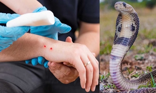 Snakebite
