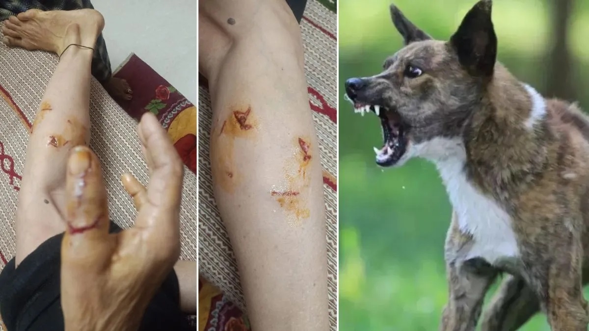 Stray dog bites 24 people in HPs Hamirpur