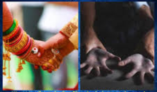 Woman sexually exploited under pretext of marriage in Misrod; accused absconding