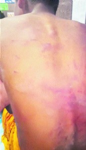 Youth kidnapped, brutally assaulted by 7 in Kolar over rivalry