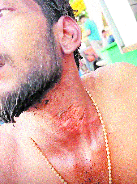 Vendor sets self ablaze