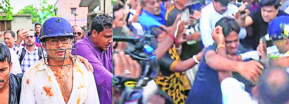 Abhishek attacked with stones