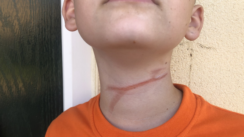 11-year-old boy dies