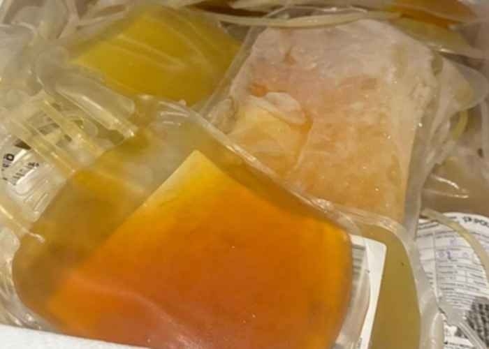 Adulterated plasma seized in Guj declared unfit for human use