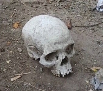 Panic in Raksha Nagar area after human skull found in garbage dump