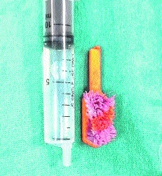 5-year-old deaf, mute child gets broken toothbrush stuck in throat