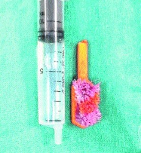 5-year-old deaf, mute child gets broken toothbrush stuck in throat