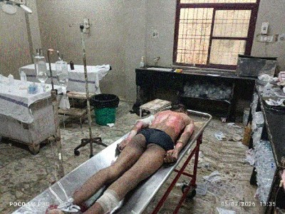 Man attempts to set himself on fire outside Madhotal Police Station