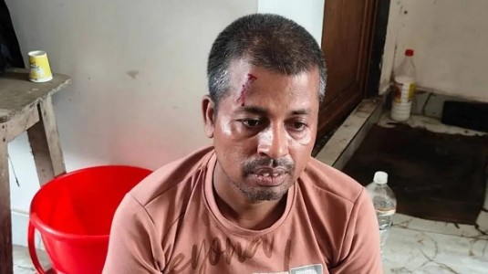 WB rape-murder case key accused killed in encounter