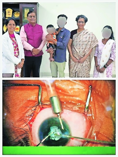 AIIMS performs complex surgery on 13-month-old